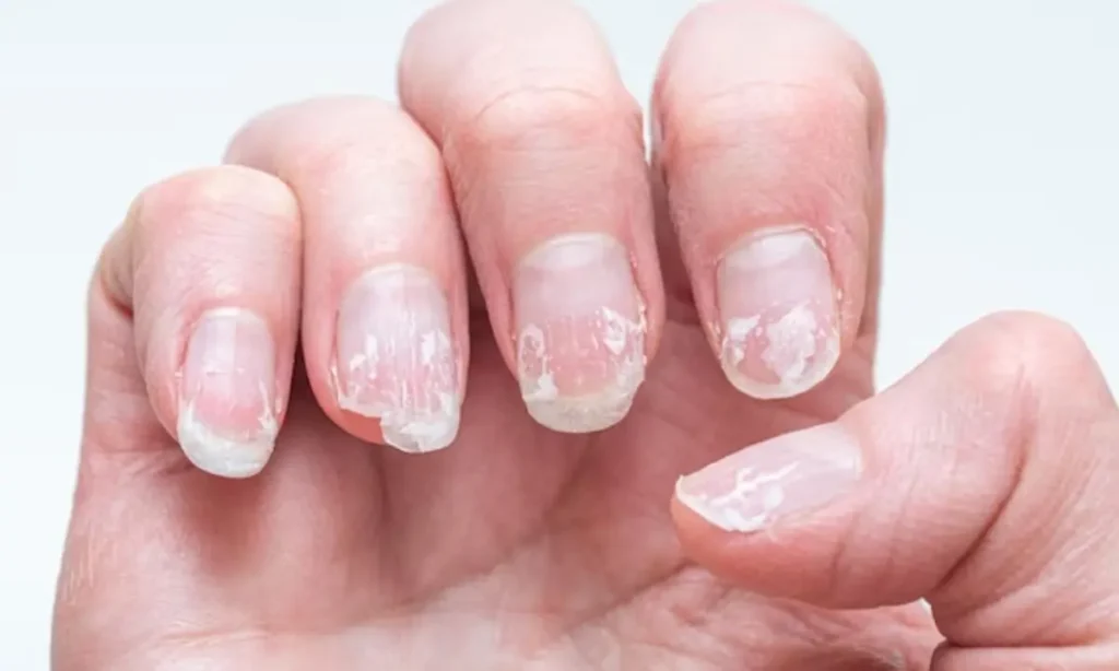 Step-by-Step Guide to a Perfect DIY Manicure at Home (2025 Edition) 17 Dermat 1