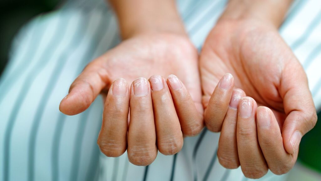 Nail Growth Secrets: Natural Ways to Strengthen and Lengthen Your Nails 3 are brittle nails a sign of a vitamin or mineral deficiency 1440x810 1