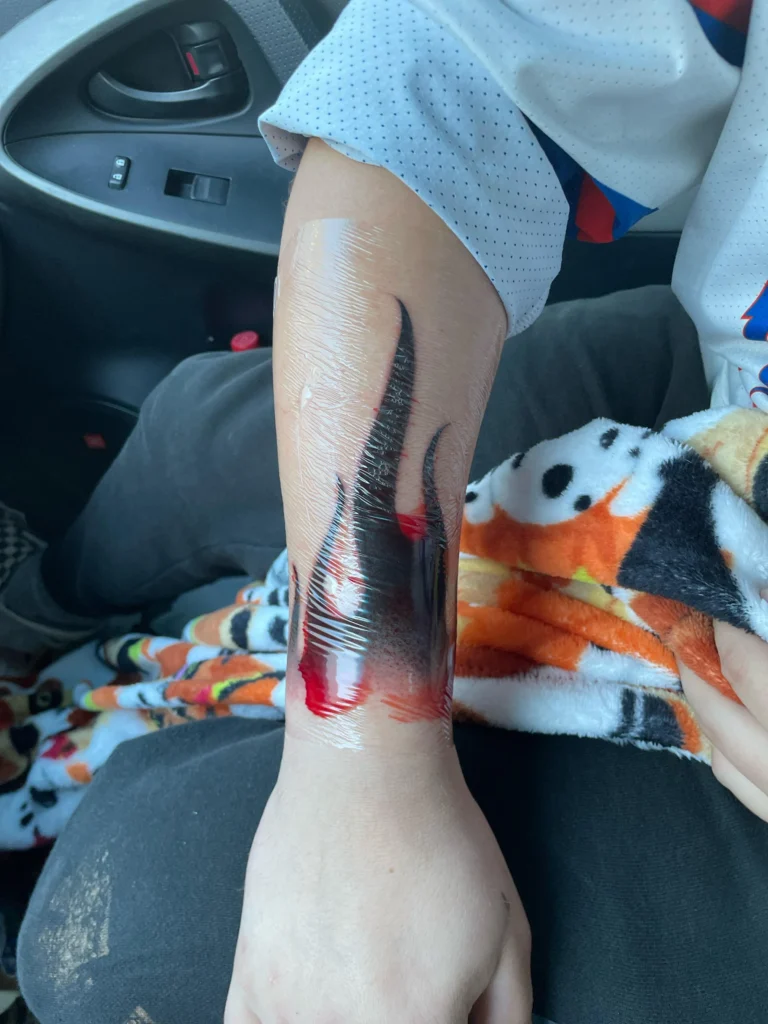 Tattoo Aftercare 101: How to Heal and Protect Your New Ink 2 can i squeegee the blood out of my tattoo bandage v0 oe7ow6urmfce1